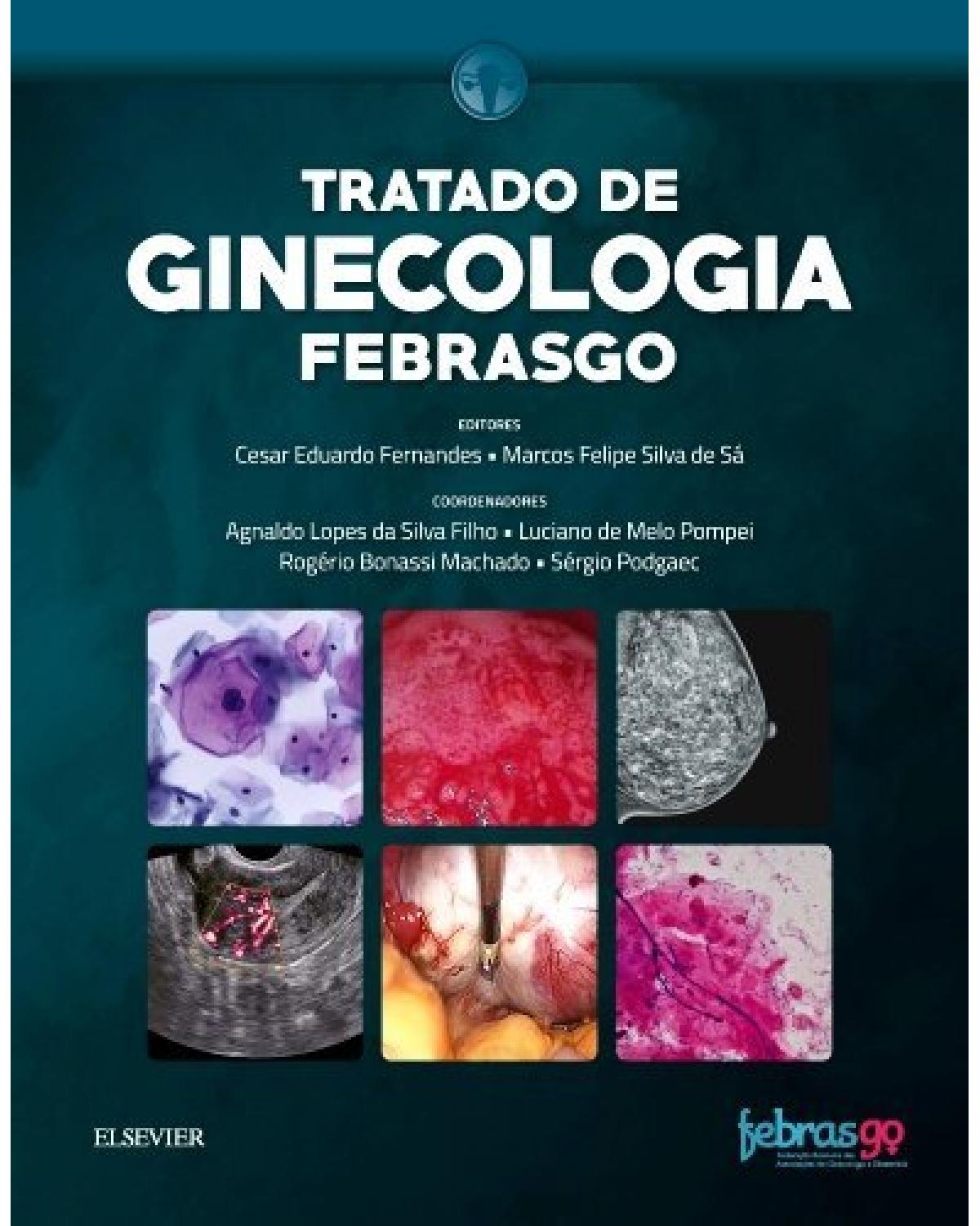 Tratado de ginecologia Febrasgo - 1ª Edição | 2018